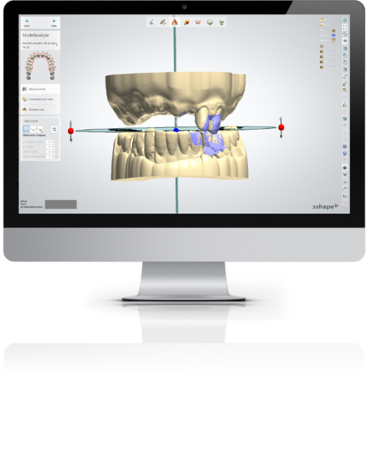 Dental digital design